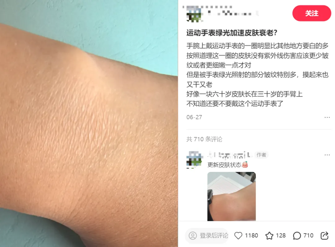 智能手表还能不能放心戴？专家建议
